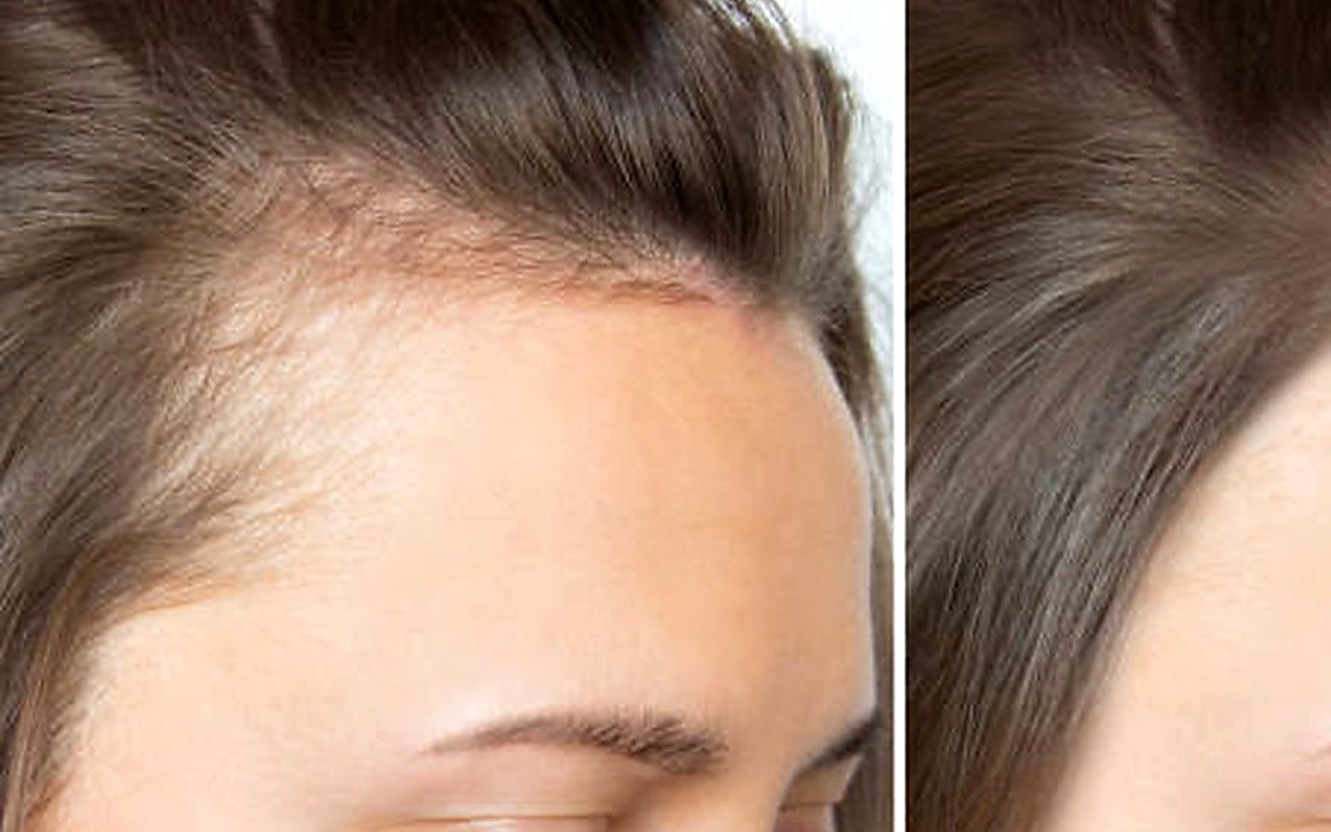 Hair Growth guides